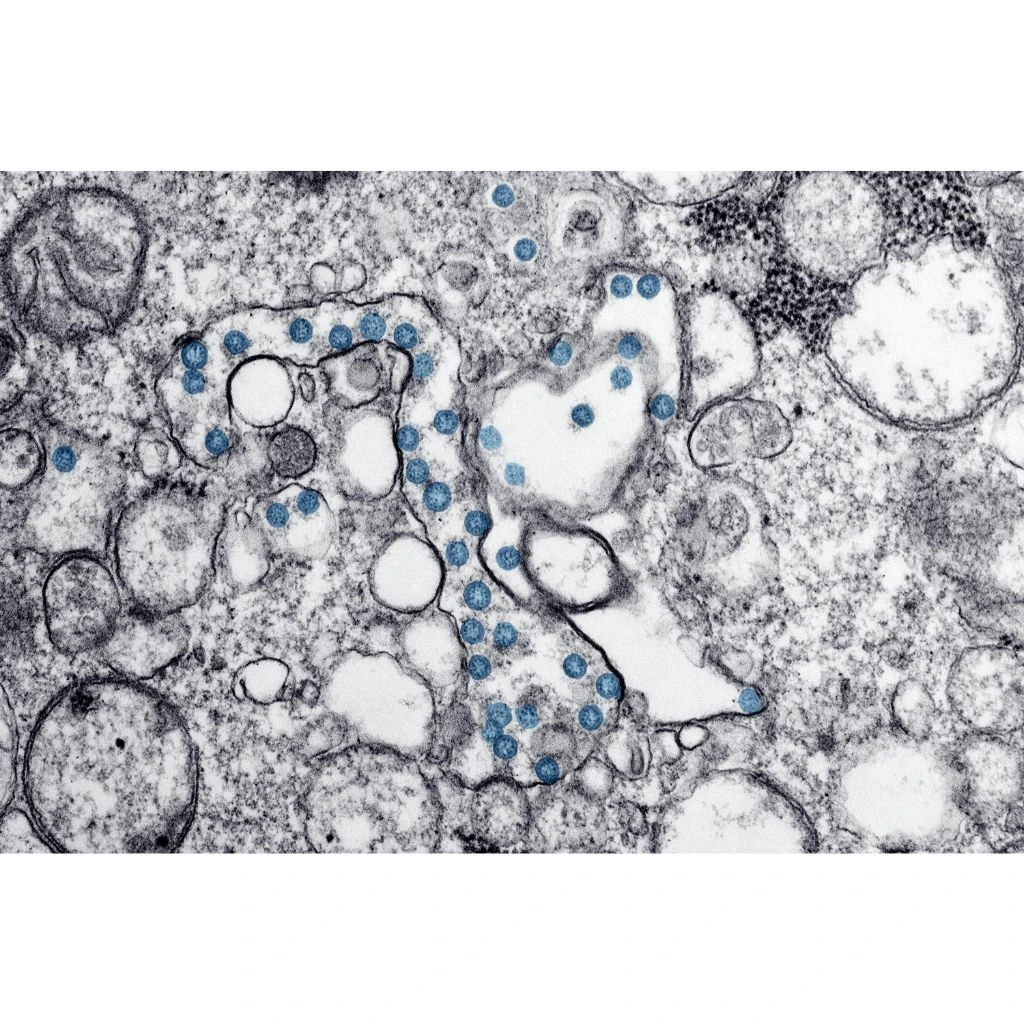 The Gut-Brain Connection